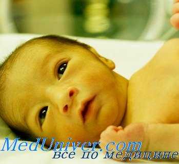 гемолитическая болезнь новорожденных