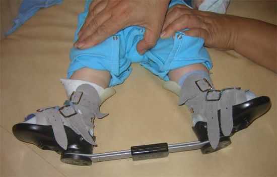 Конструкция для исправления ортопедических патологий