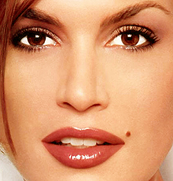 Профилактика развития меланомы