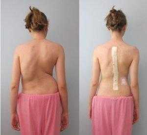 Подростковый