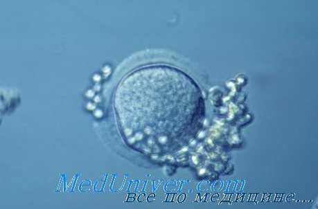 донорство яйцеклетки