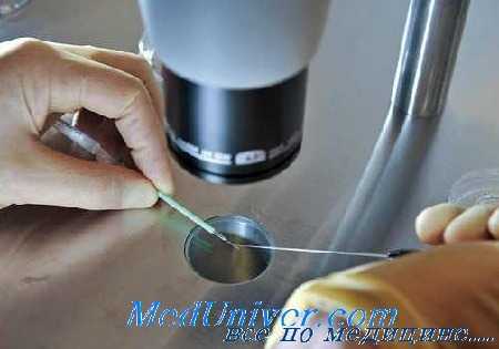 эффективность ЭКО