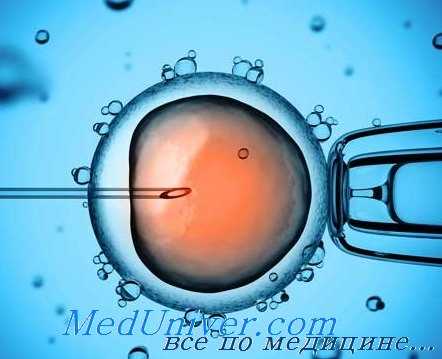 вспомогательные репродуктивные технологии