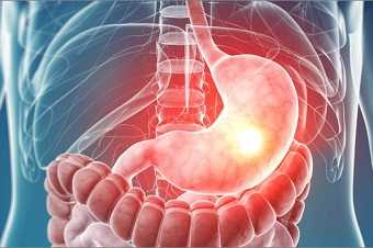 Болезни оперированного желудка