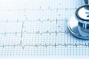 Пороки сердца у беременных