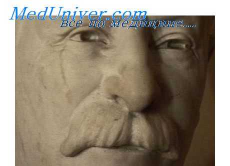 симптомы головокружения