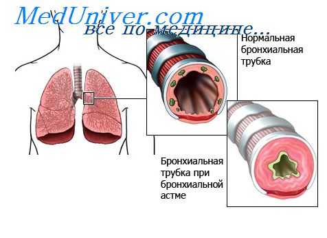 защитные функции макрофагов