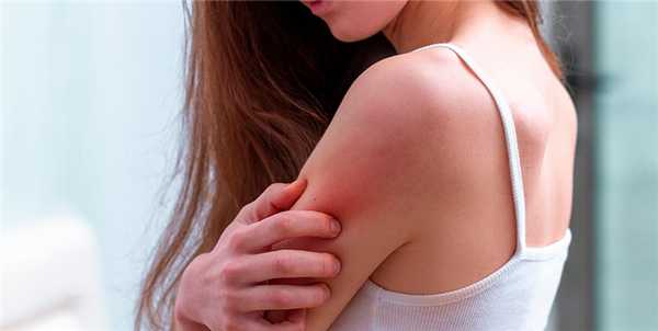 Заразен ли дерматит