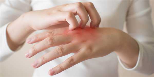 Виды дерматита