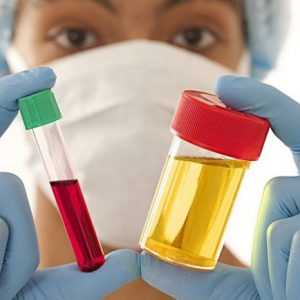 Анализ крови и мочи