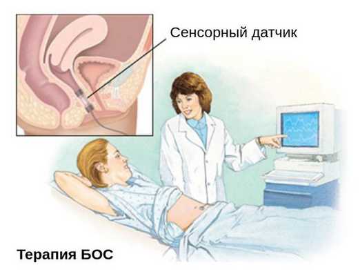 БОС терапия