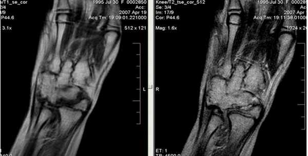 МРТ кисти: когда назначается?