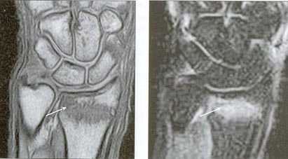 МРТ кисти: когда назначается?