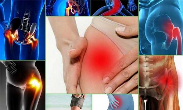 Ушиб в районе тазобедренного сустава.jpg