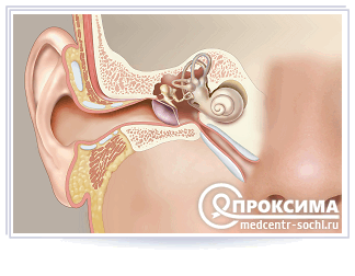Когда используется транстимпанальный метод введения лекарств
