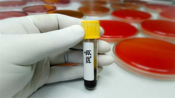 Что такое антитела