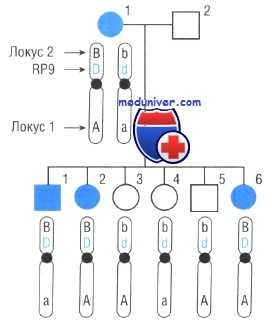 сцепление генов пигментного ретинита