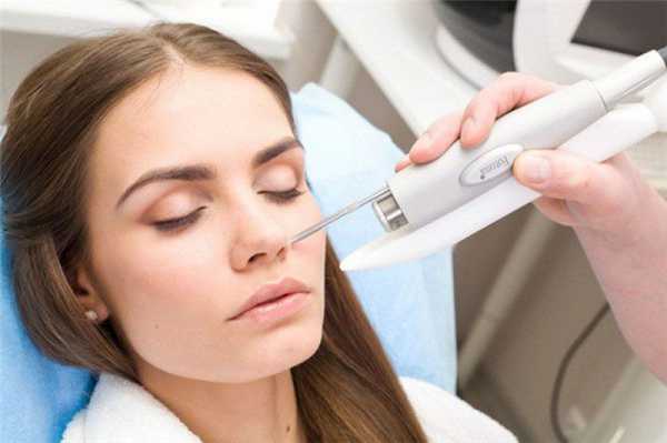 Коагуляция сосудов носа лазерным методом