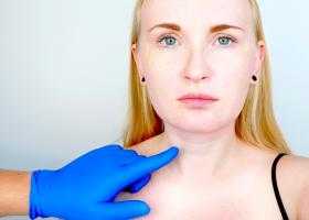 Как убрать кольца Венеры на шее?