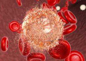 Миелолейкоз