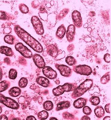 Микрофотография риккетсии.