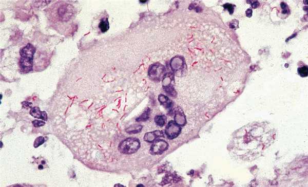 бактерии Rickettsia