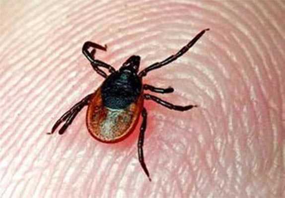 Заражение риккетсиозом через укус клеща.