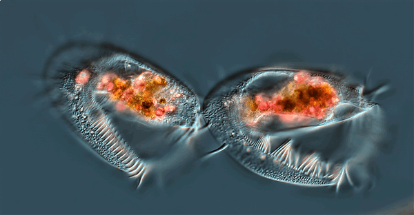 Завершающая стадия клеточного деления инфузории