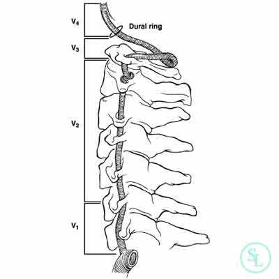Протезирование диска
