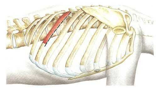 Проекция разреза мягких тканей при выполнении переднебокового трансторакального доступа к позвоночнику.
