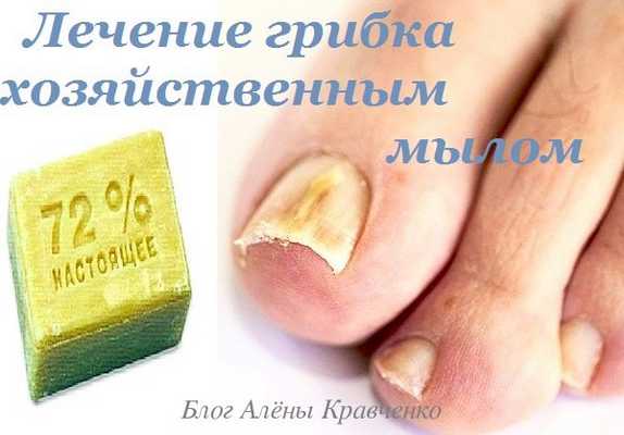Хозяйственное мыло от грибка