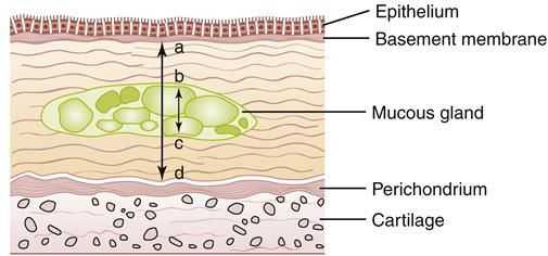 Абсцесс легкого