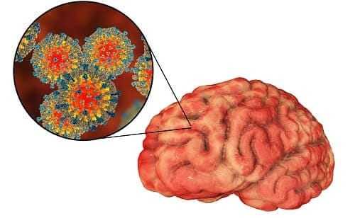 Инфекции мозга