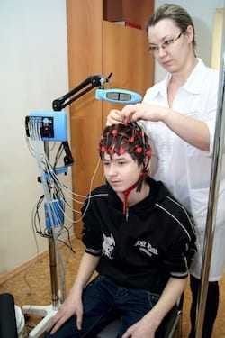 эпилепсия, стресс, судорожные состояния, эпилептик, припадки