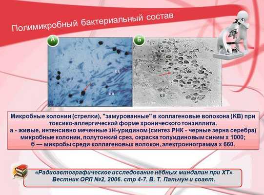 Полимикробный бактериальный состав