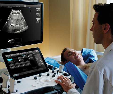 Ключица, вид сверху