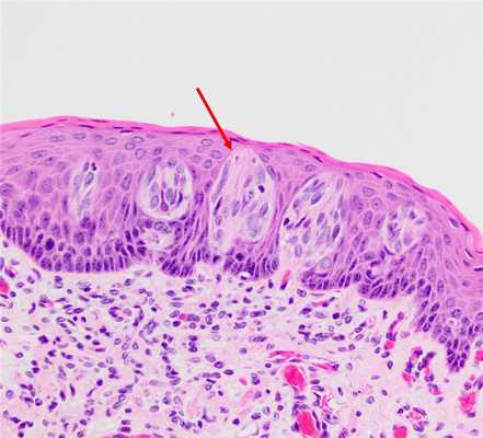 мышцы языка гистология