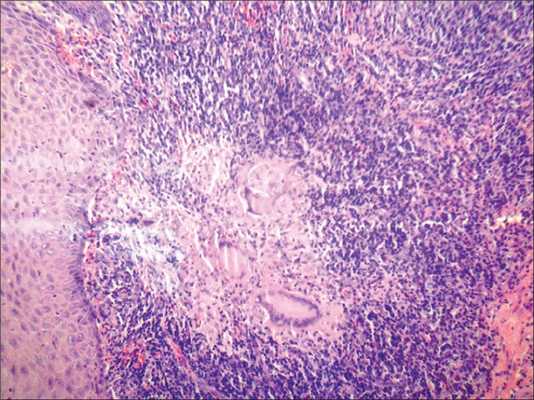 гистология языка