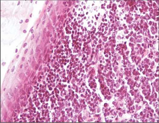 вкусовые почки языка гистология