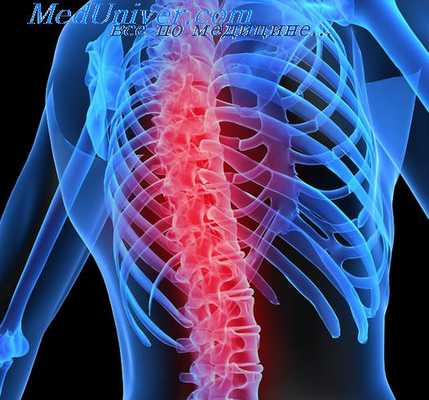 боли при болезнях артерий