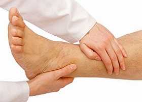 Облитерирующий эндартериит