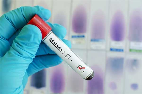 Риск малярии: опасная инфекция