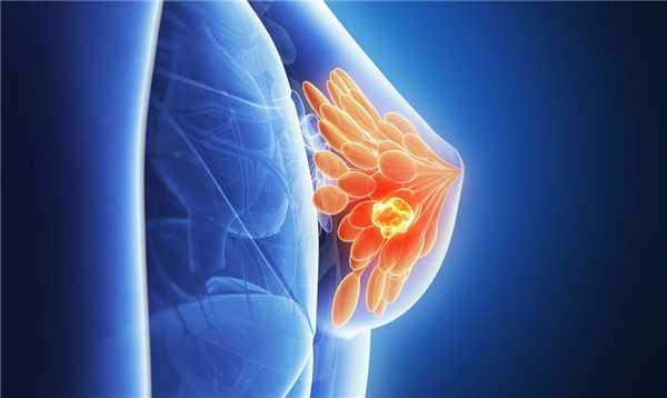 Мастопатия молочной железы – симптомы и диагностика. Как лечить мастопатию?