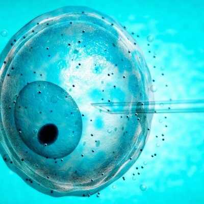 Пункция ооцитов