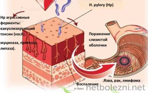 Действие агрессивных ферментов