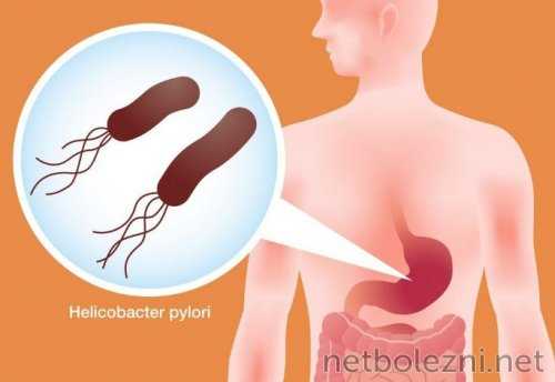 Инфекция в желудке