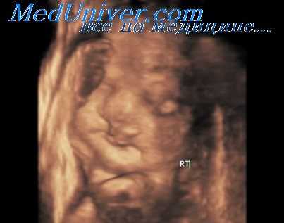 внутриутробное развитие плода