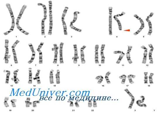 задержка внутриутробного развития