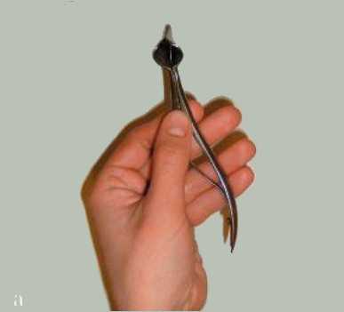 риноскопия