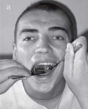 риноскопия